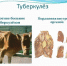 ПАМЯТКА ДЛЯ НАСЕЛЕНИЯ ПО ПРОФИЛАКТИКЕ ТУБЕРКУЛЕЗА ЖИВОТ-НЫХ. - Шипуновский район